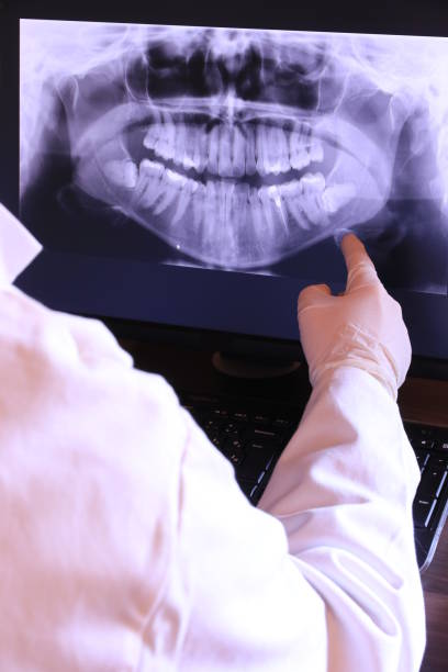 Best Root Canal Emergency Dentist  in Laureldale, PA
